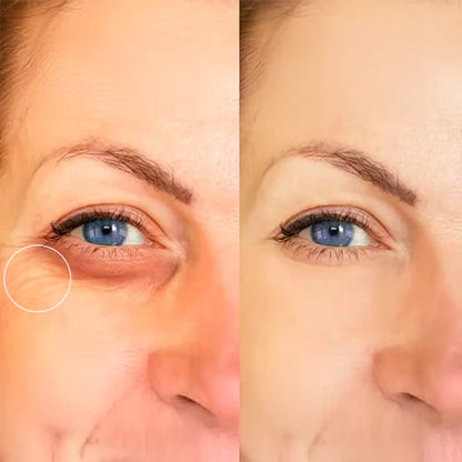 COSRX 60 Parches de Hidrogel| Bolsas y ojeras visiblemente reducidas desde el primer uso!