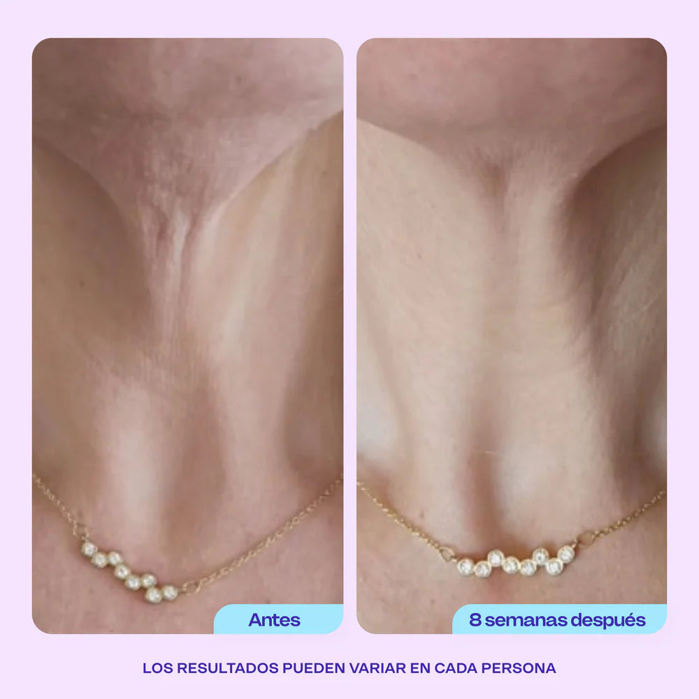 Crema Lifting Neck | Rejuvenece tu Cuello y Escote. Lleva 1 de regalo!