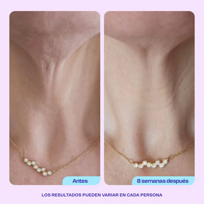 Crema Lifting Neck | Rejuvenece tu Cuello y Escote. Lleva 1 de regalo!