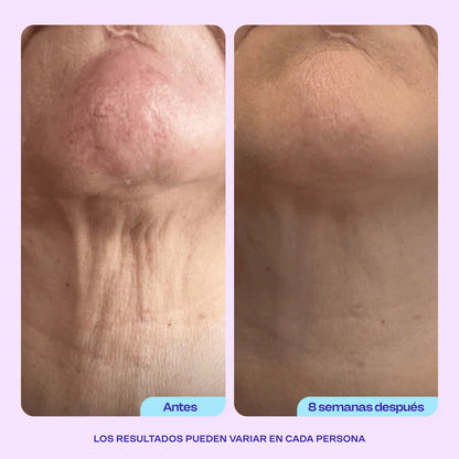 Crema Lifting Neck | Rejuvenece tu Cuello y Escote. Lleva 1 de regalo!