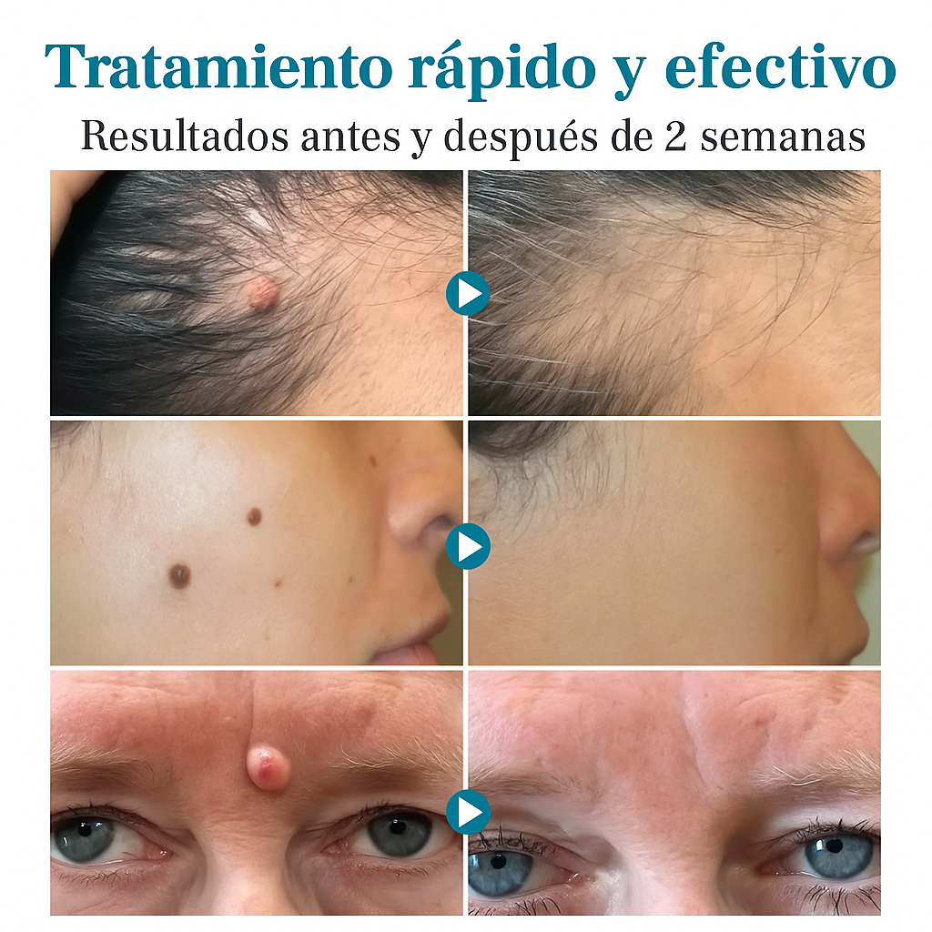 Dermo Glow | Elimina imperfecciones al instante