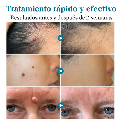 Dermo Glow | Elimina imperfecciones al instante