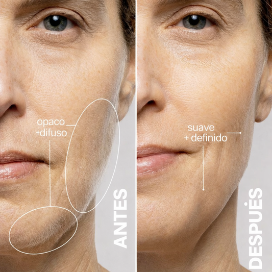 Sonic Dermaplaning | Elimina el vello facial y exfolia con un mismo producto!