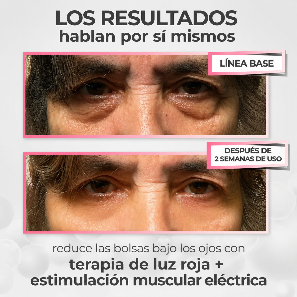 Lentes antiaojeras