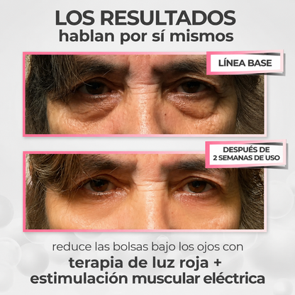 Lentes antiaojeras