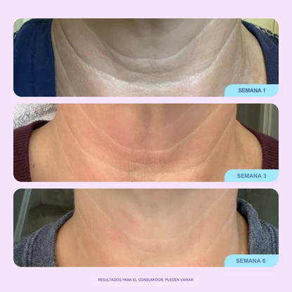 Crema Lifting Neck | Rejuvenece tu Cuello y Escote. Lleva 1 de regalo!