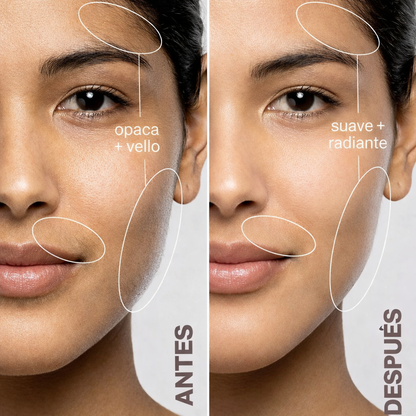 Sonic Dermaplaning | Elimina el vello facial y exfolia con un mismo producto!