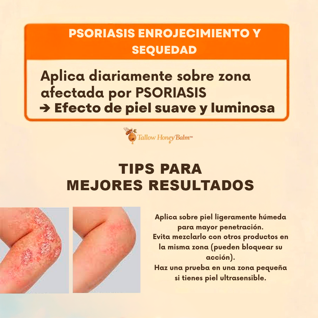 Crema de Sebo Res & Miel Piel Hidratada | Devuélvele a tu Piel la Suavidad que Creías Perdida!