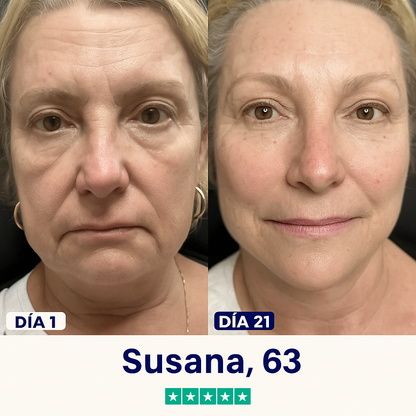 Mascarilla Anti Papada | Elimina y reduce grasa bajo el mentón